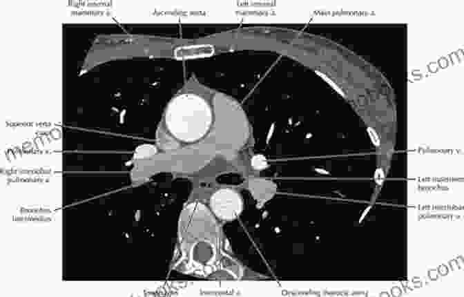 Atlas Of Non Invasive Imaging In Cardiac Anatomy CT Atlas Of Non Invasive Imaging In Cardiac Anatomy