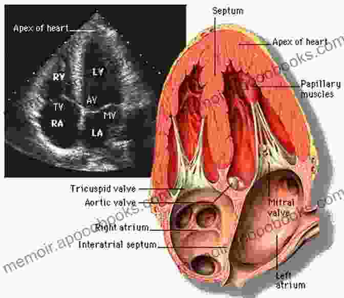 Atlas Of Non Invasive Imaging In Cardiac Anatomy Echocardiography Atlas Of Non Invasive Imaging In Cardiac Anatomy