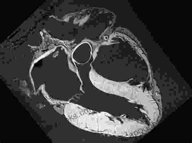 Atlas Of Non Invasive Imaging In Cardiac Anatomy MRI Atlas Of Non Invasive Imaging In Cardiac Anatomy