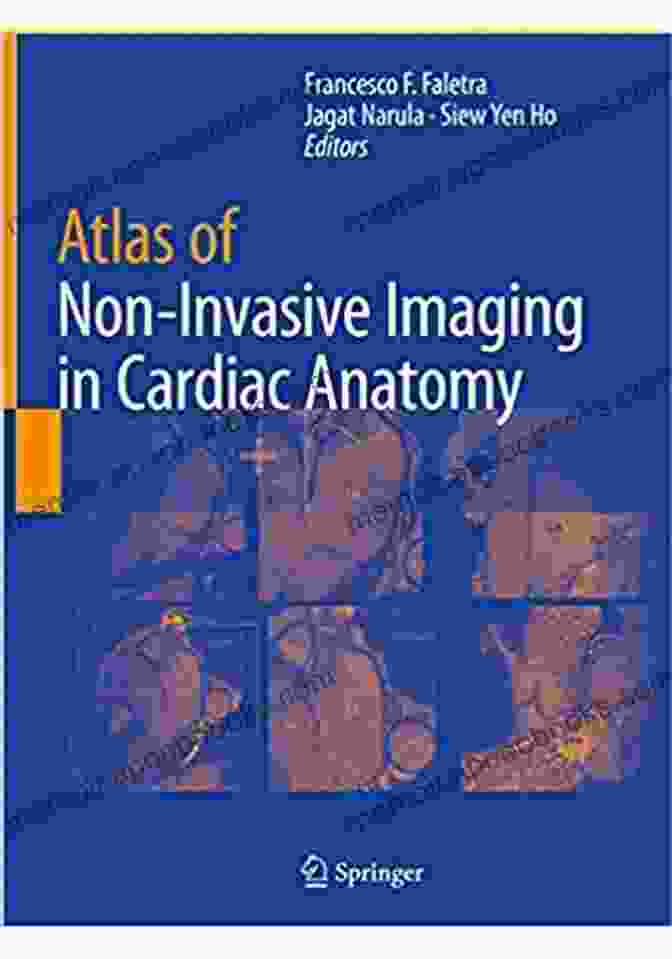 Atlas Of Non Invasive Imaging In Cardiac Anatomy Nuclear Medicine Atlas Of Non Invasive Imaging In Cardiac Anatomy