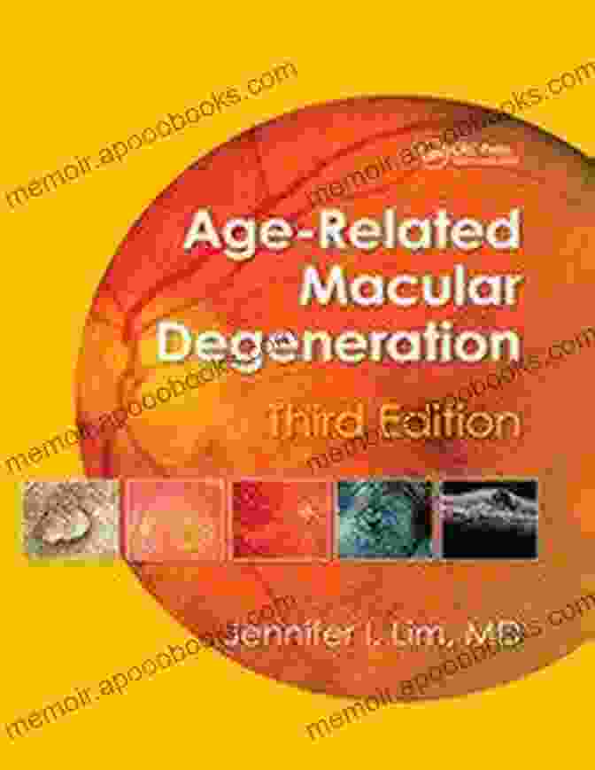 Book Cover Of Age Related Macular Degeneration: The Ultimate Guide Age Related Macular Degeneration: Diagnosis Symptoms And Treatment An Overview (Ophthalmology No 1)