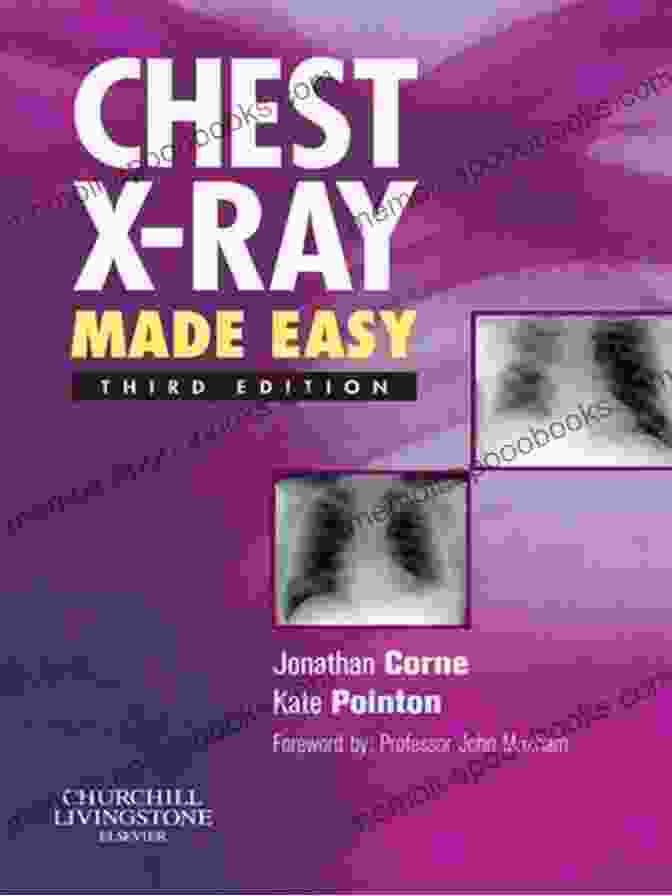 Chest Ray Made Easy Book Cover Chest X Ray Made Easy Adolph Barr