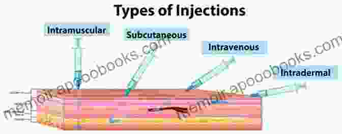 Diagram Illustrating Different Injection Techniques For Injectable Fillers Illustrated Manual Of Injectable Fillers: A Technical Guide To The Volumetric Approach To Whole Body Rejuvenation (Series In Cosmetic And Laser Therapy)