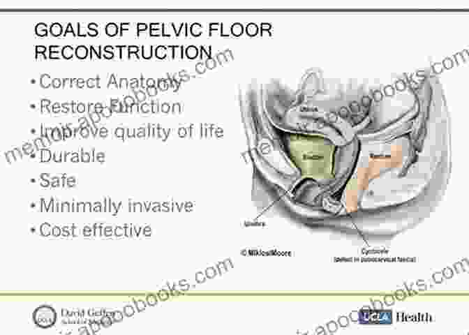 Pelvic Floor Reconstruction Image Recent Advances In Coloproctology Adolph Barr