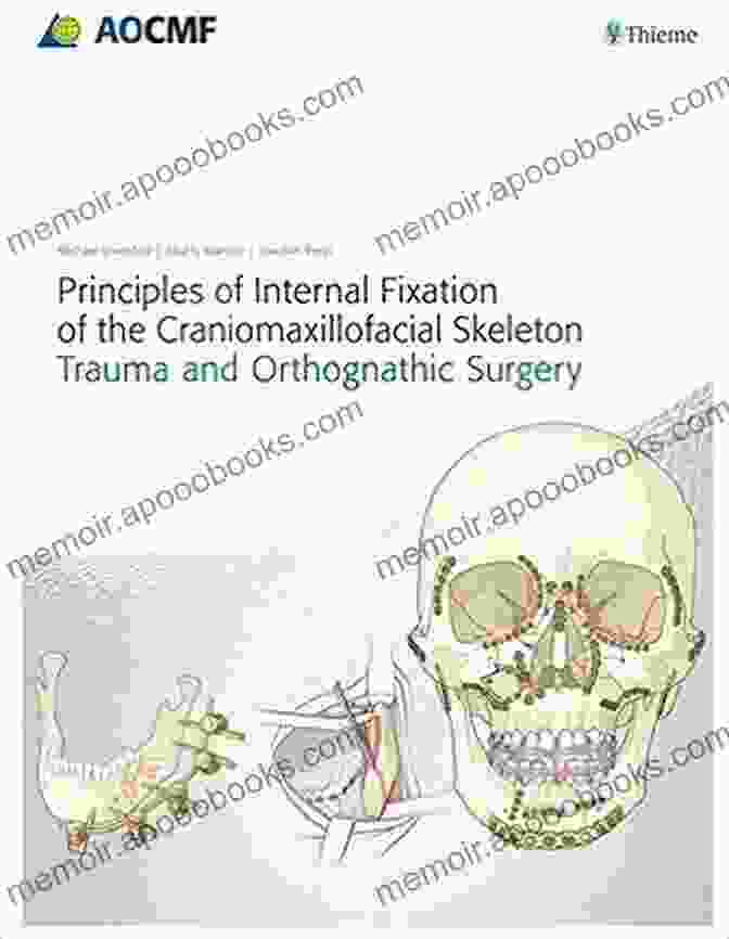 Principles Of Internal Fixation Of The Craniomaxillofacial Skeleton Book Cover Principles Of Internal Fixation Of The Craniomaxillofacial Skeleton: Trauma And Orthognathic Surgery