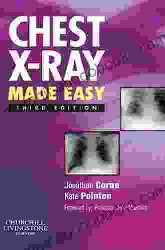 Chest X Ray Made Easy Adolph Barr