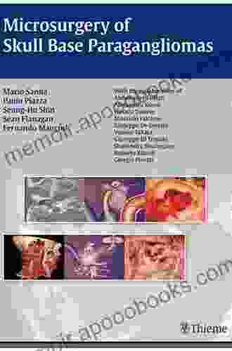 Microsurgery Of Skull Base Paragangliomas