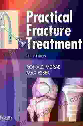 Practical Fracture Treatment Adolph Barr