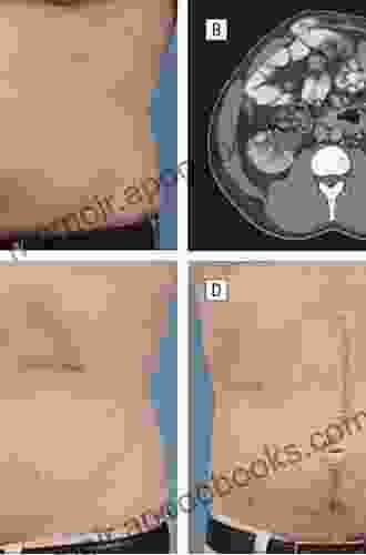 Atlas Of Head And Neck Cancer Surgery: The Compartment Surgery For Resection In 3 D