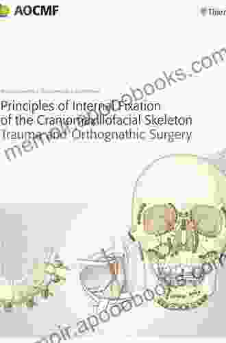 Principles of Internal Fixation of the Craniomaxillofacial Skeleton: Trauma and Orthognathic Surgery