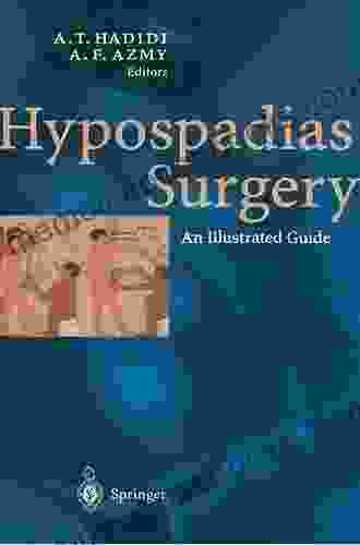 Hypospadias Surgery: An Illustrated Guide