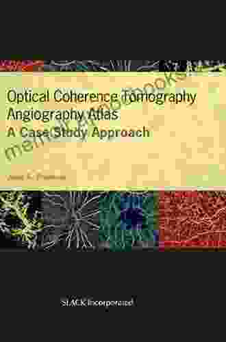 Optical Coherence Tomography Angiography Atlas: A Case Study Approach